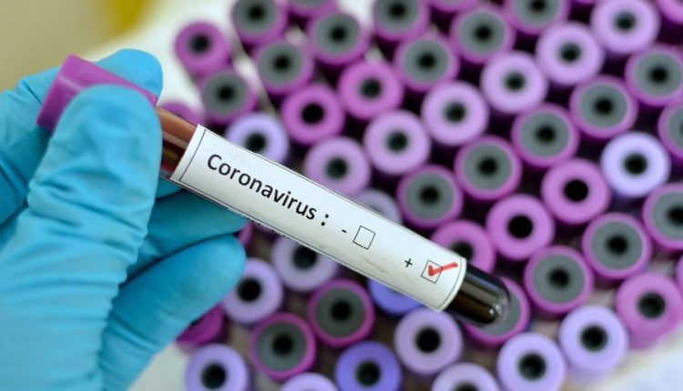 Four COVID-19 Positive patient detect in Bhadrak